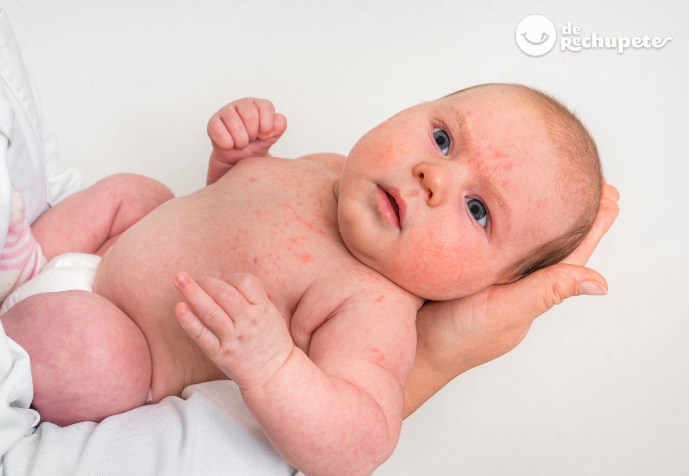 Alergia a la proteína de la leche de vaca. ¿Qué es y cómo saber si somos alérgicos?