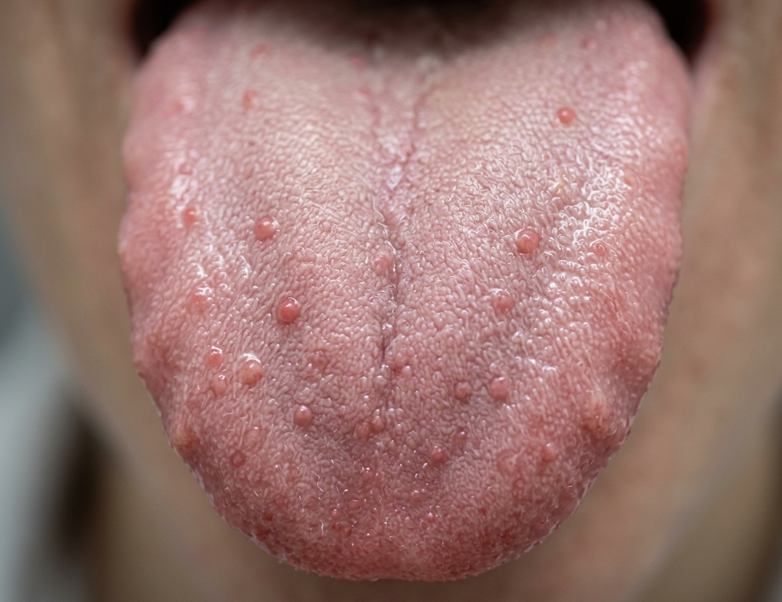 ¿Existe el sexto sabor? Lo que dice la ciencia sobre los nuevos sabores que podemos percibir